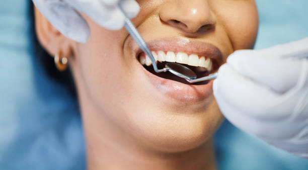 Best Emergency Care for Gum Disease in University Place, WA